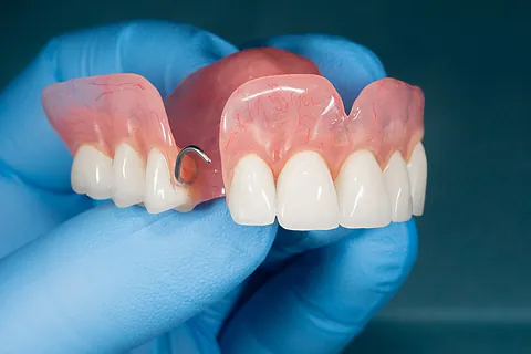 manos sosteniendo prótesis dental acrílica